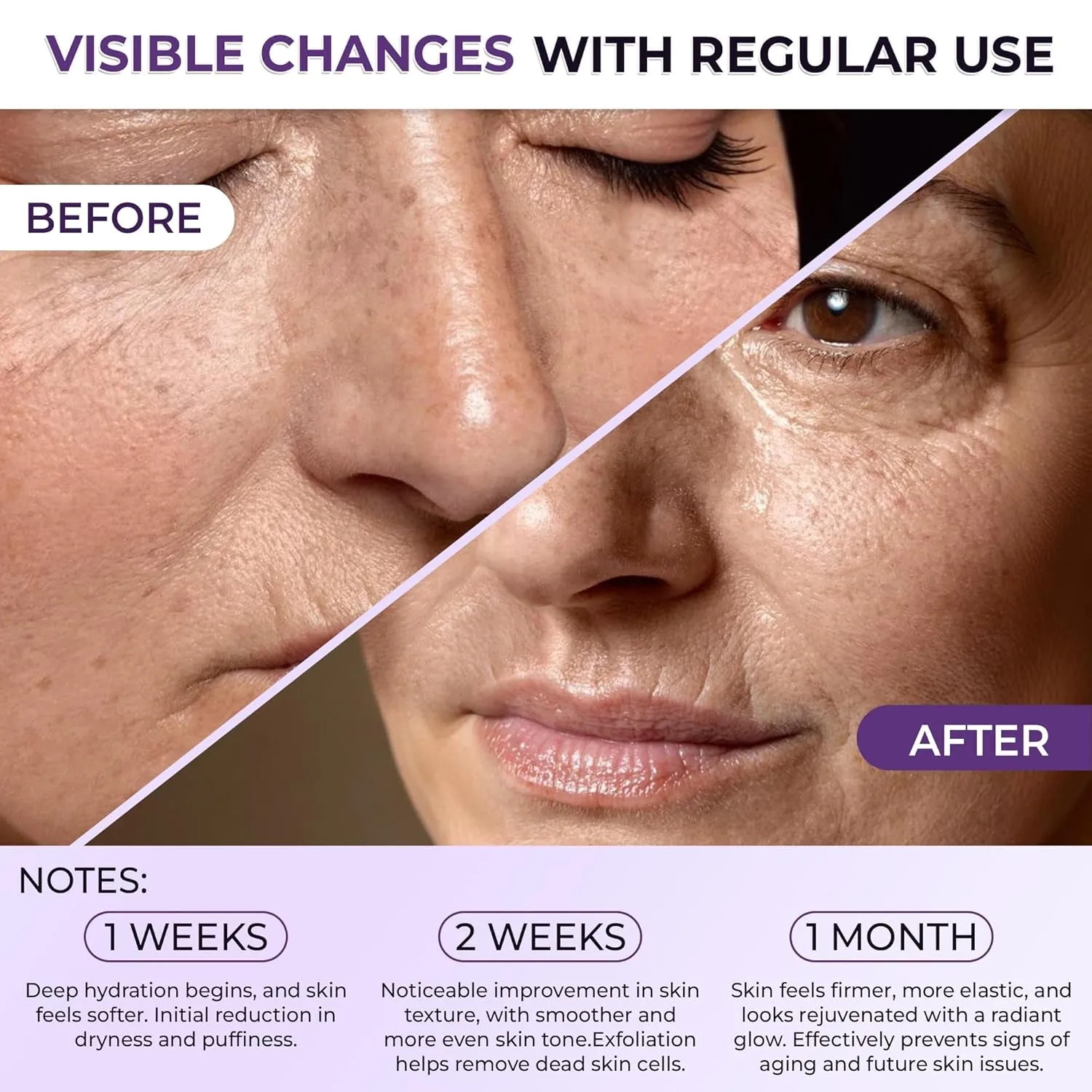 BELANI Retinol Night Cream for Women, Dark Spot Remover, Melasma Treatment, Reduce Fine Lines, Anti-Wrinkle, Anti-Aging Neck and Décolleté for Face (2 Box   Gift Eyelash Serum)