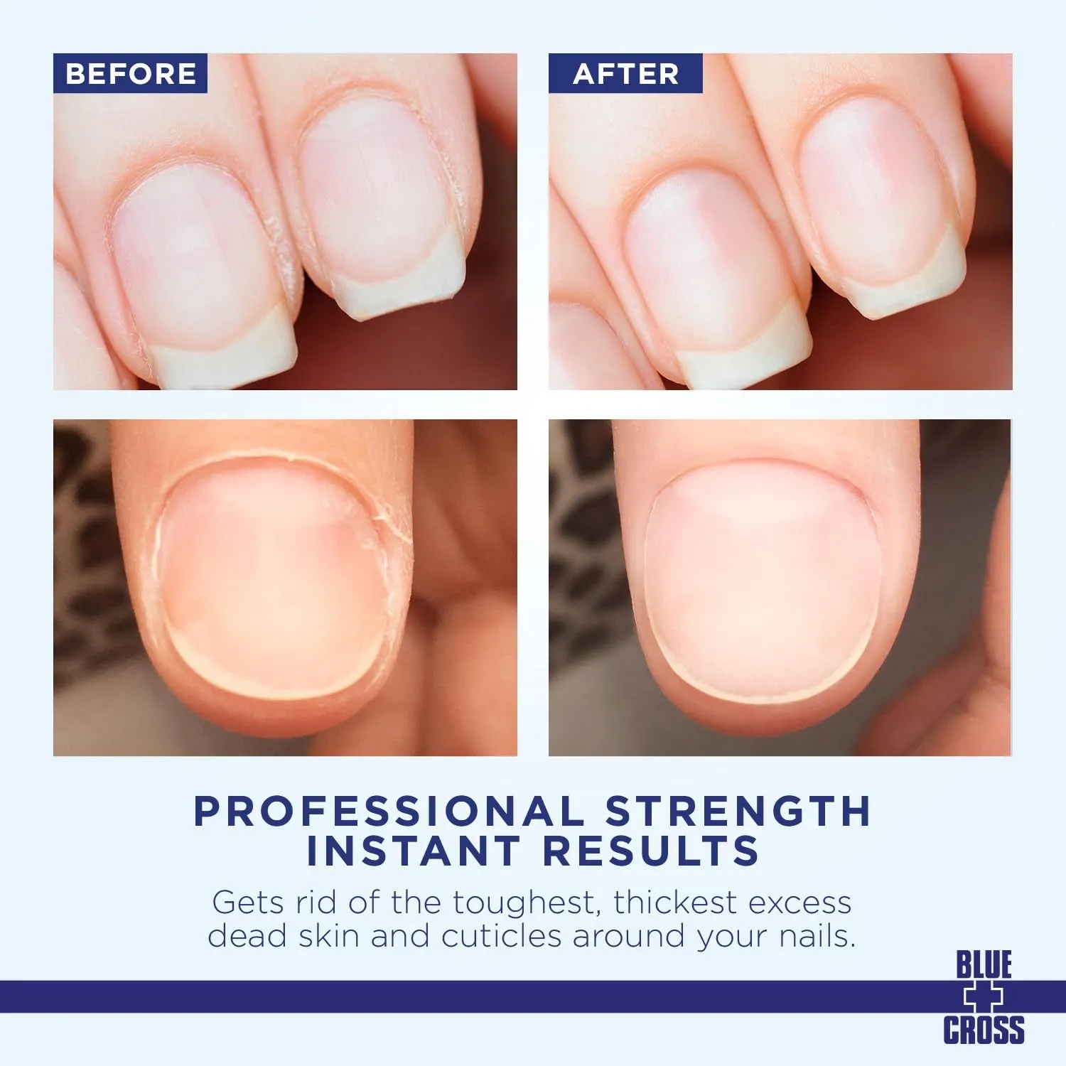 Cuticle Remover Cream for Dry Damaged Cuticles, Moisturizing Cuticle Softener for Nails, Professional Nail Care for Dry Manicures, Brittle Hang Nails, Made in USA, 2Oz