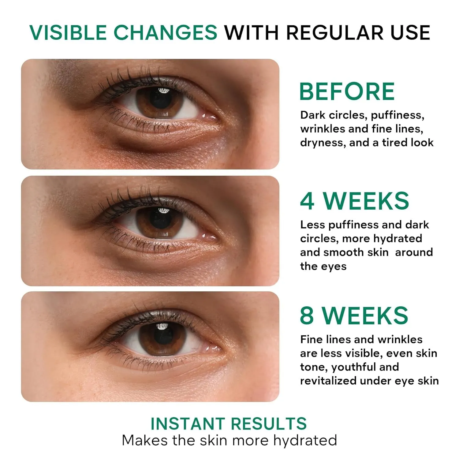 Eye Cream for Dark Circles and Puffiness, Bags under Eyes Treatment, Anti-Aging Collagen Eye Cream for Wrinkles, Day & Night Caffeine Eye Cream with Niacinamide Dimethicone