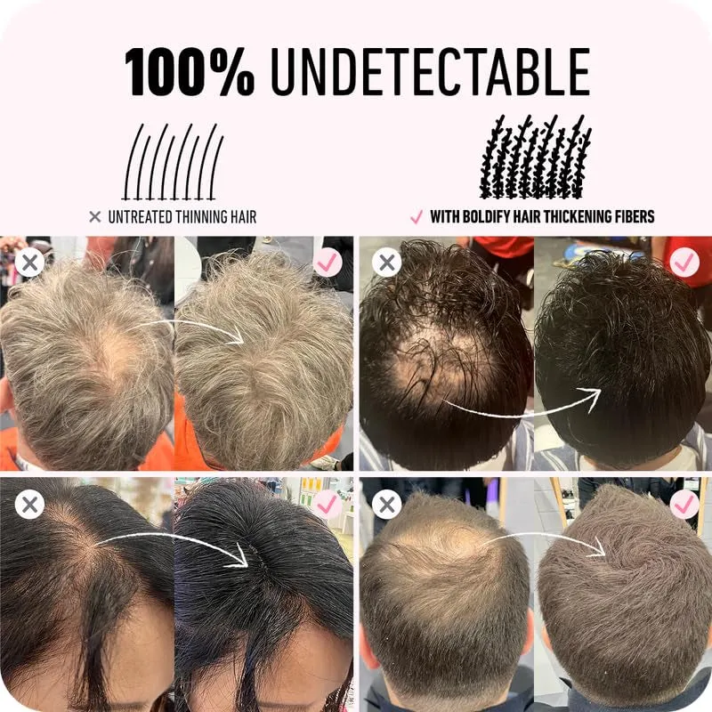 Hair Fibers (28G) - Fill in Thinning and Fine Hair for an Instantly Fuller, Thicker Look - 14 Shades for Women & Men - Dark Brown