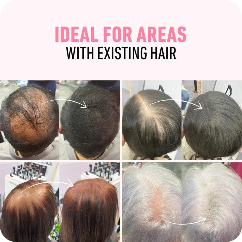 Hair Fibers (28G) - Fill in Thinning and Fine Hair for an Instantly Fuller, Thicker Look - 14 Shades for Women & Men - Dark Brown
