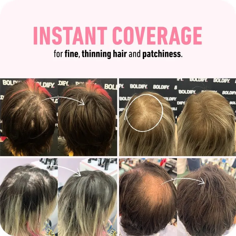 Hair Fibers (28G) - Fill in Thinning and Fine Hair for an Instantly Fuller, Thicker Look - 14 Shades for Women & Men - Dark Brown