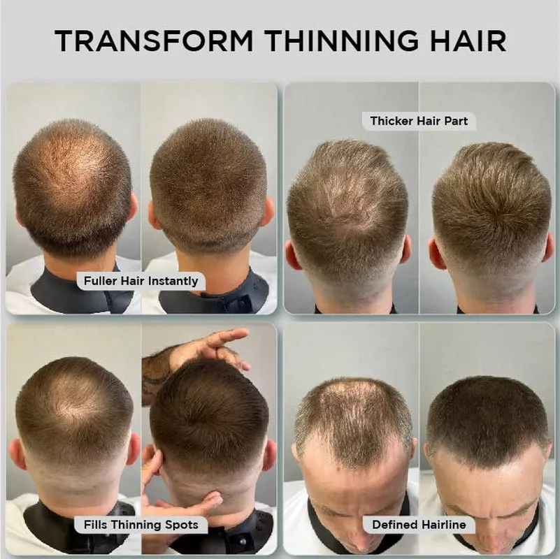 Hair Fibers for Thinning Hair & Bald Spots (DARK BROWN) - 25G Bottle - Conceals Hair Loss in Seconds - Hair Powder for Women & Men