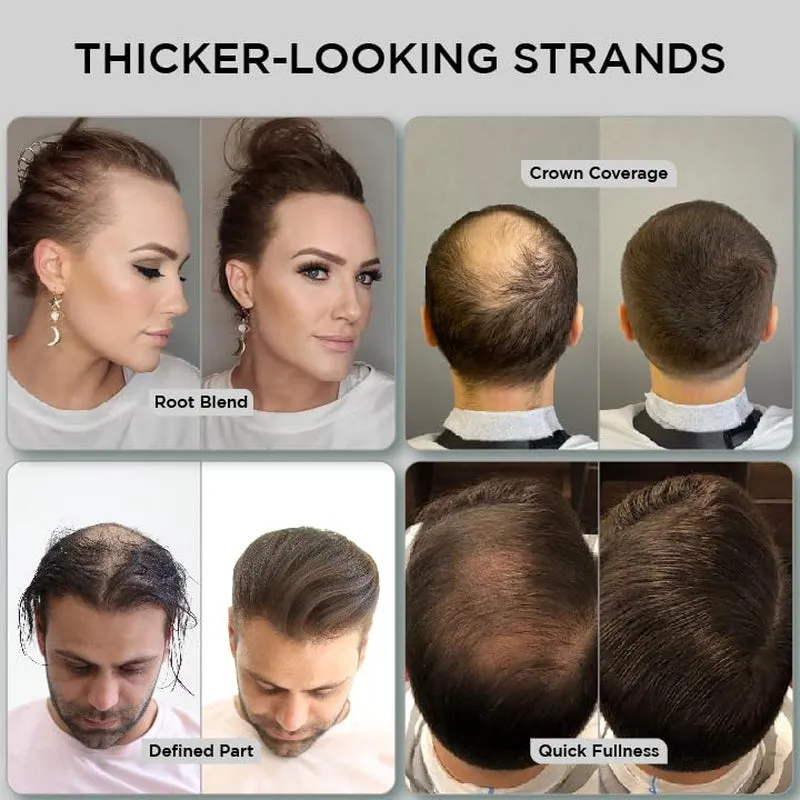 Hair Fibers for Thinning Hair & Bald Spots (DARK BROWN) - 25G Bottle - Conceals Hair Loss in Seconds - Hair Powder for Women & Men