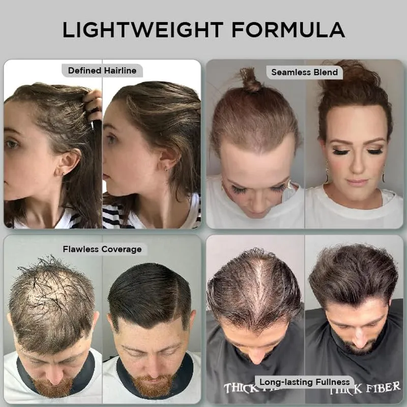 Hair Fibers for Thinning Hair & Bald Spots (DARK BROWN) - 25G Bottle - Conceals Hair Loss in Seconds - Hair Powder for Women & Men