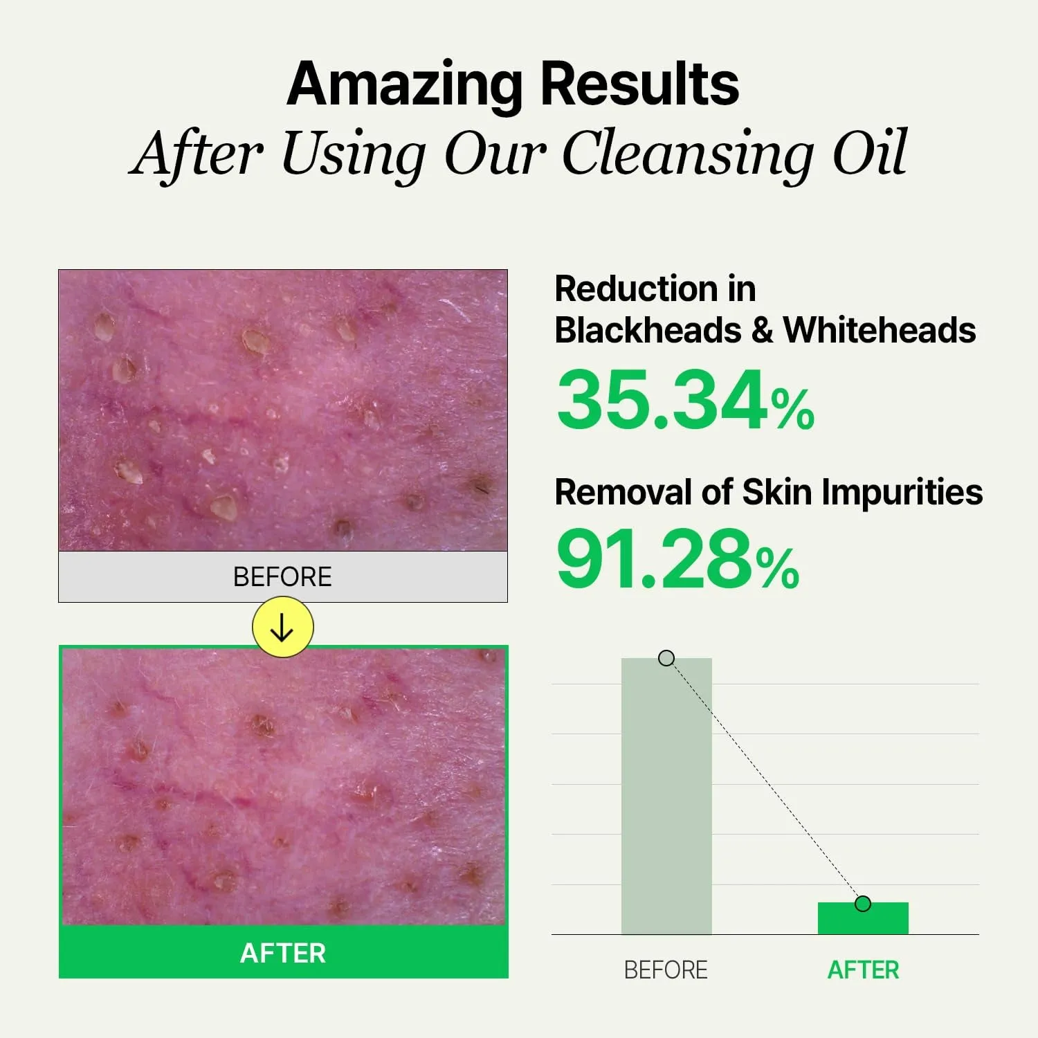 LHA Deep Cleansing Oil, Makeup, Blackhead and Whitehead Remover, Korean Skin Care, Vegan, 6.93 Fl Oz