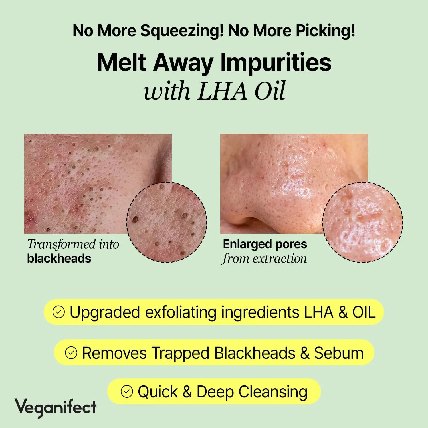 LHA Deep Cleansing Oil, Makeup, Blackhead and Whitehead Remover, Korean Skin Care, Vegan, 6.93 Fl Oz