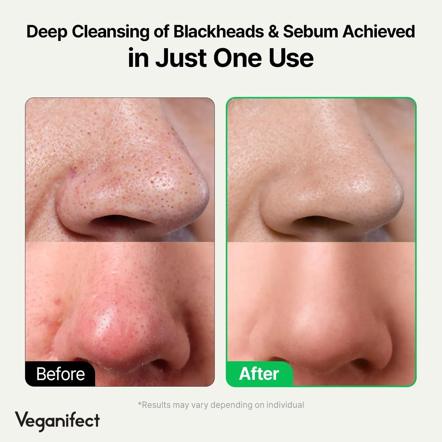 LHA Deep Cleansing Oil, Makeup, Blackhead and Whitehead Remover, Korean Skin Care, Vegan, 6.93 Fl Oz