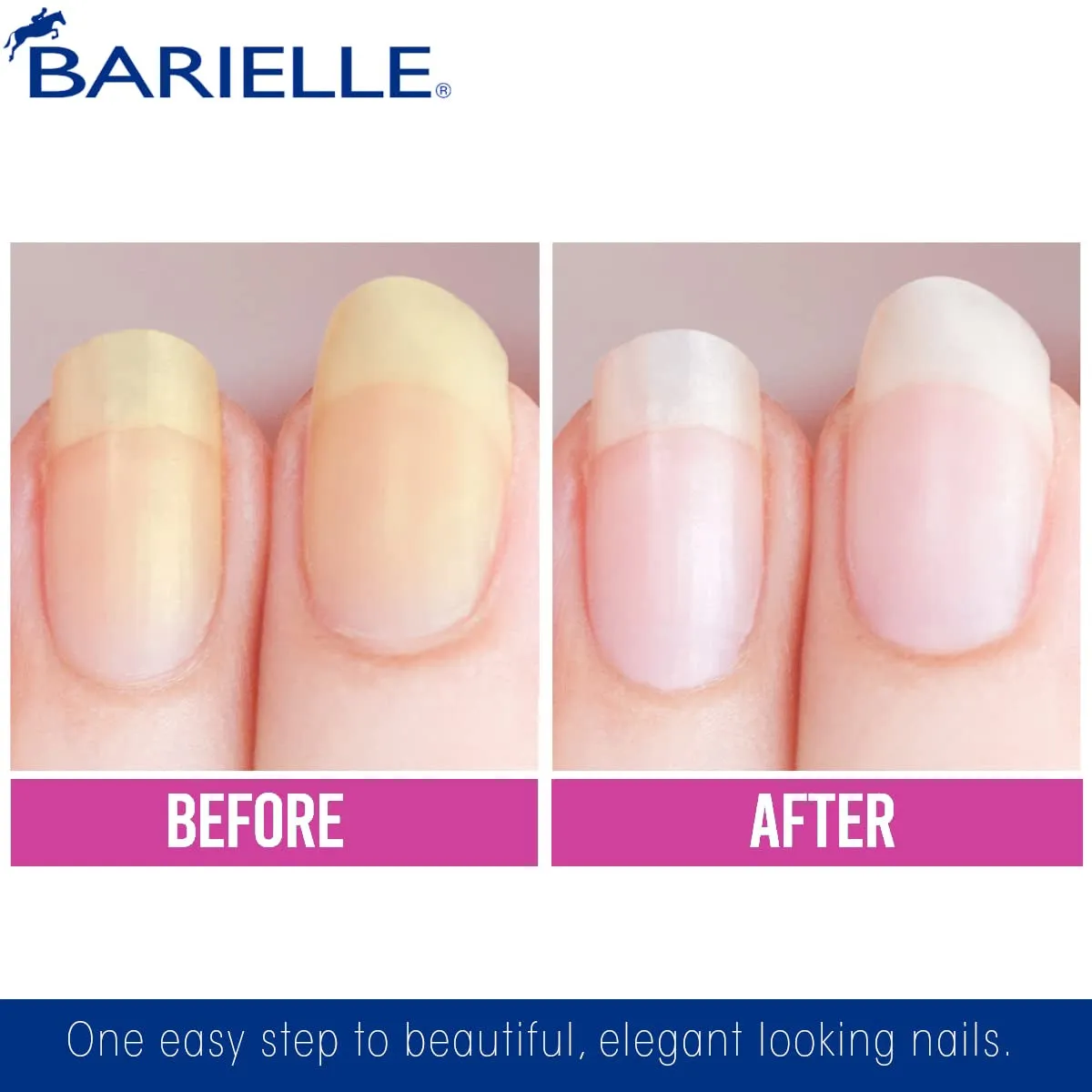 Nail Whitener for Yellow Nails or Dull Nails .47 Oz. (PACK of 2) - Whitening for Nails, Treats Yellow Nails