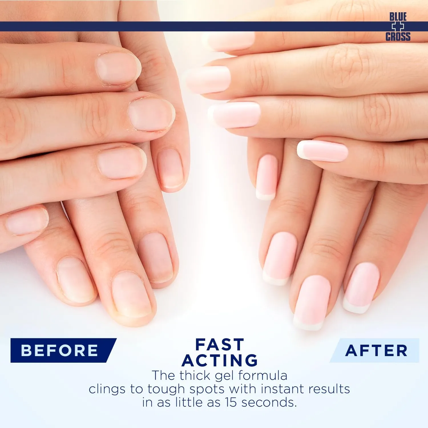 Professional Nail   Cuticle Care, Nail Whitener Optical Nail Brightening Basecoat & Citrus Scented Cuticle Remover Softener Gel, 2 Pack Bundle